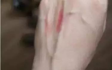手上青筋