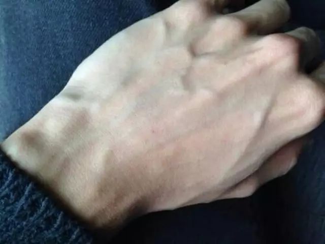 手背青筋