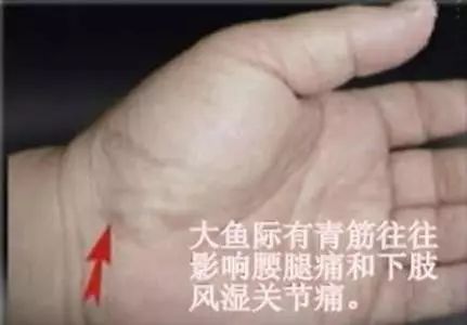 手掌青筋:大鱼际有青筋