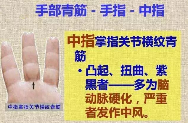手指青筋