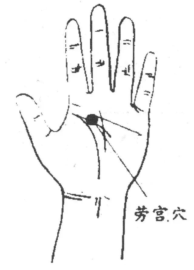 劳宫穴